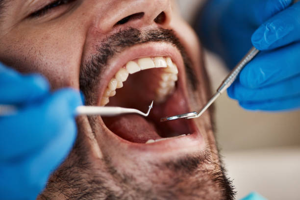 Best Dentist for Tooth Abscess  in Goldens Bridge, NY