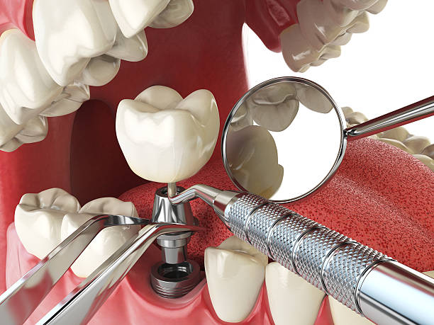 Best Cracked Tooth Emergency Dentist  in Goldens Bridge, NY